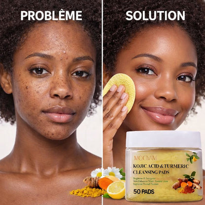 Peau lumineuse en 7 jours - PADS AU CURCUMA & ACIDE KOJIQUE